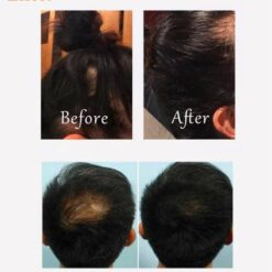 EMS Electric Liquid Import Hair Regrowth Comb Head Massager - Image 4