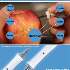 IBNUSA™ 3 in 1 Ultrasonic Plasma Facial Spot Removal Beauty Device - Image 7
