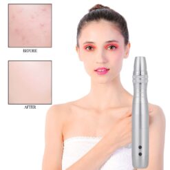7 LED Photon Micro-Needling Electric Derma Pen With Micro Needle-iBeautyneed