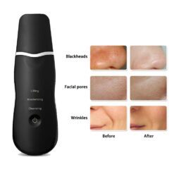 3 Modes Rechargeable Ultrasonic Scrubber Facial Spatula Cleaner-iBeautyneed