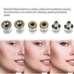 3 Wands 9 Tips for Facial Peeling Diamond Microdermabrasion Machine-iBeautyneed