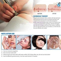 3 Wands 9 Tips for Facial Peeling Diamond Microdermabrasion Machine-iBeautyneed