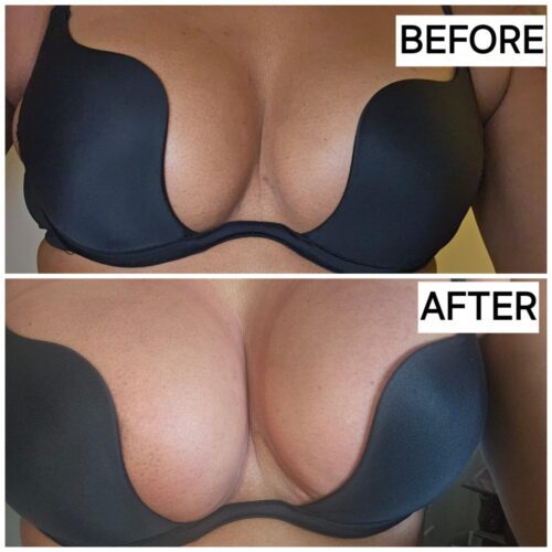 IBNUSA™ Vacuum Breast Buttocks Enlarger Pump Dual Cup Massager photo review