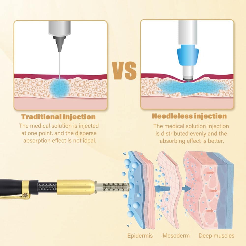 IBNUSA™ 2 in 1 0.3ml/ 0.5ml Hyaluron Pen Lip Filler Kit - Image 4