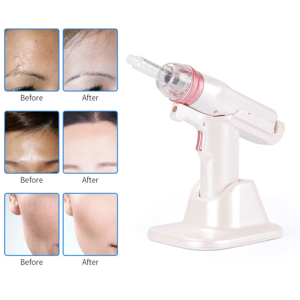 Mesotherapy EZ Negative Pressure Meso Microcrystal Gun-iBeautyneed