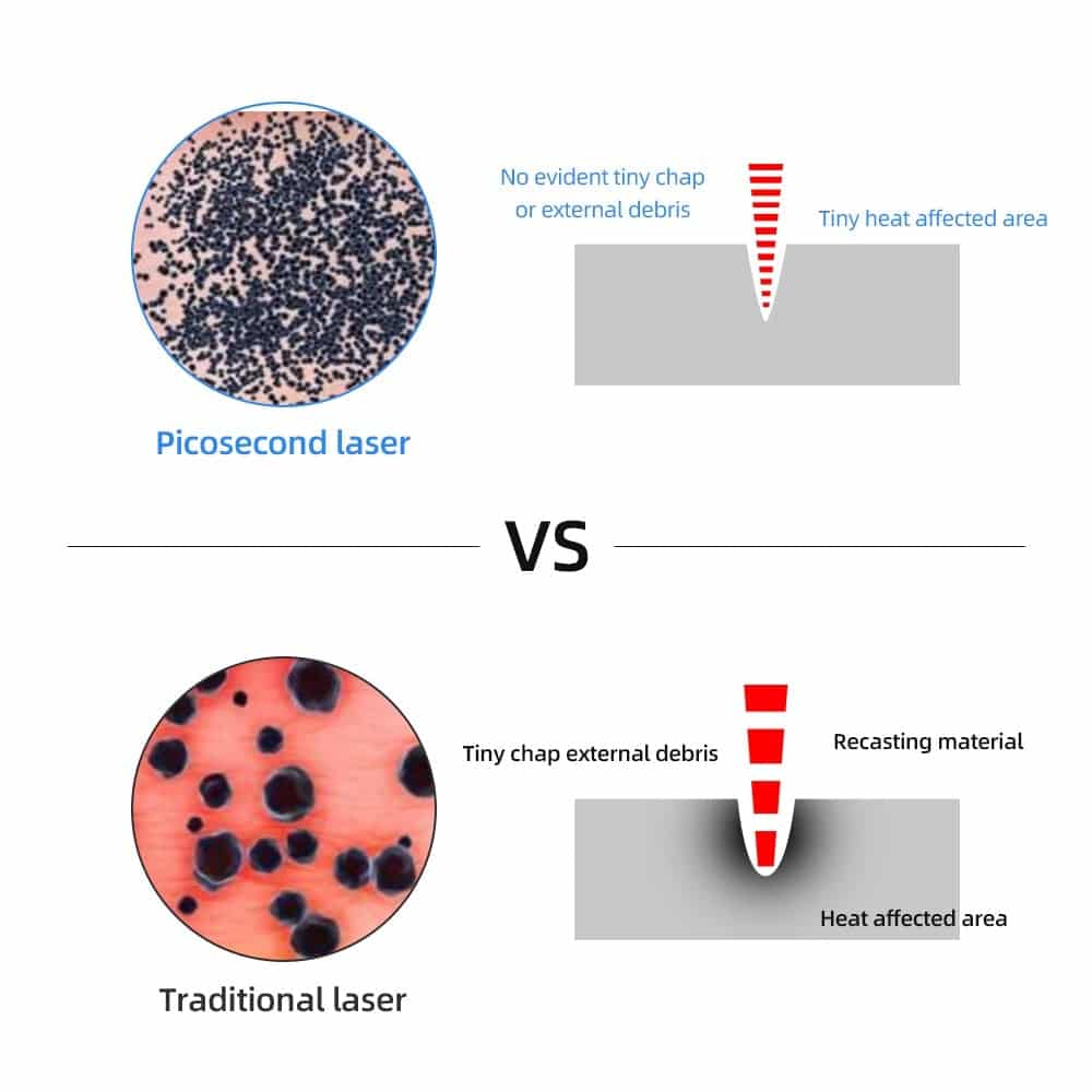 IBNUSA™ Piaosy 9+9 Laser Picosecond Pen Tattoo Freckle Mole Scar Removal Pen - Image 7