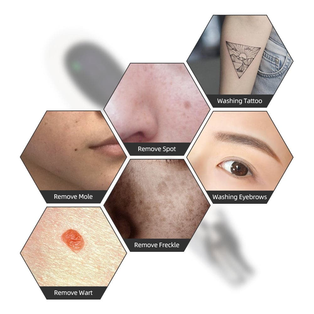 IBNUSA™ Piaosy 9+9 Laser Picosecond Pen Tattoo Freckle Mole Scar Removal Pen - Image 8